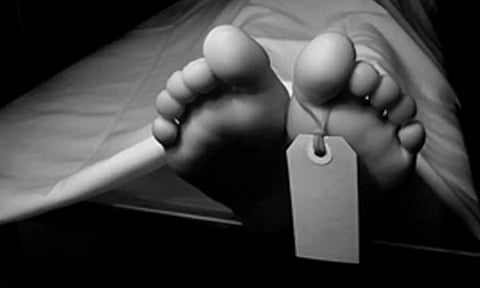 Representative Image