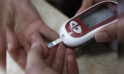 Representative image