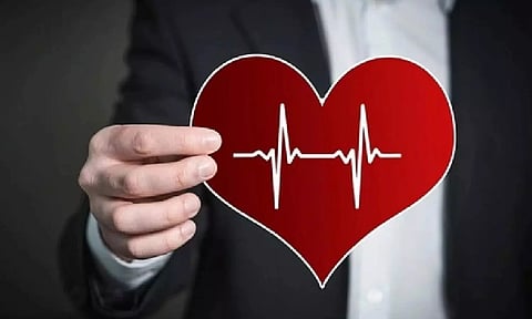 Representative image