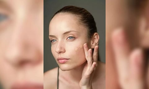 Representative image