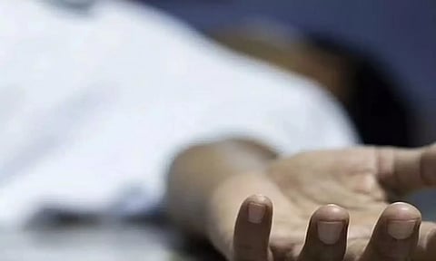 Representative image