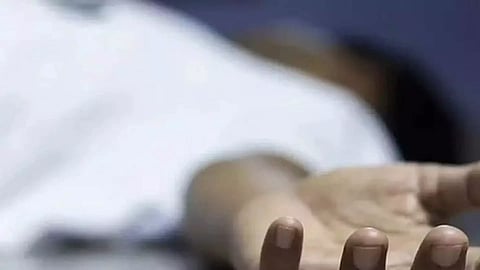 Representative Image