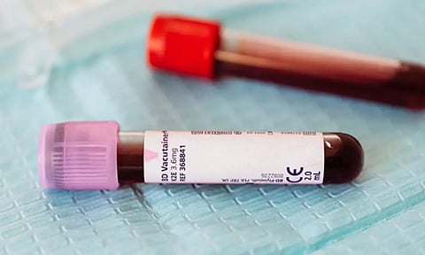 Representative image (PHOTO: ANI)