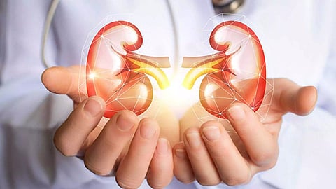 Representative Image