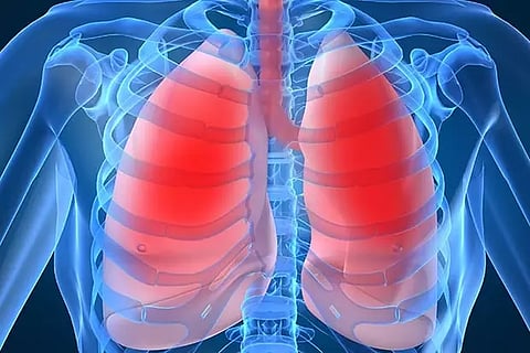 Omega-3 fatty acids help in maintaining lung health: Study