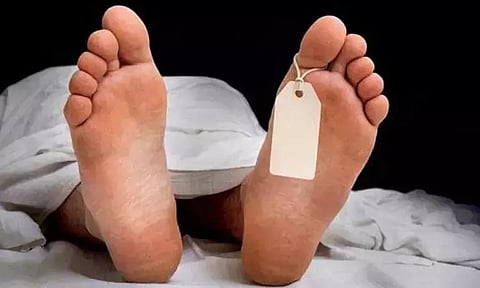 Representative image