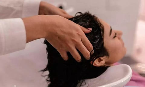 Representative image