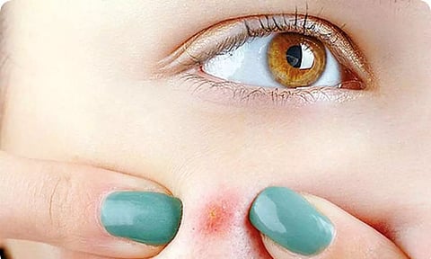 Representative image