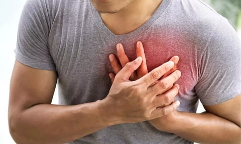 Representative Image