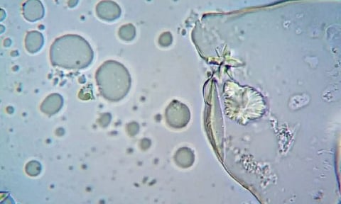 Representative Image (ANI)