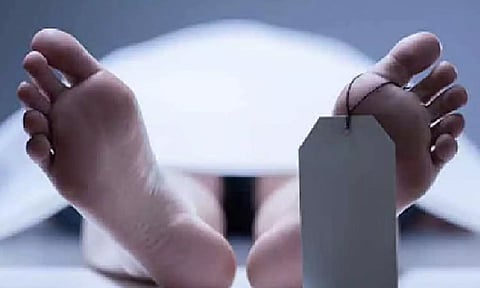 Representative Image