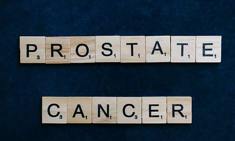 Representative image (ANI)