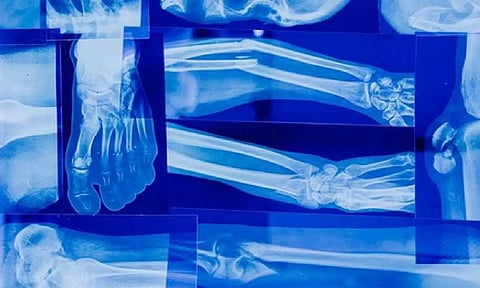 Representative image