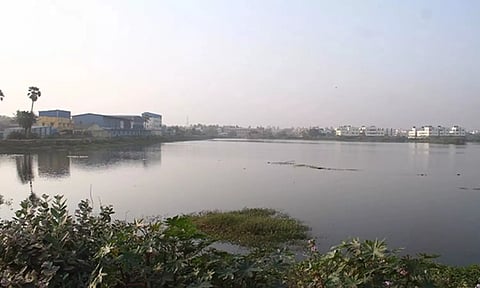 Representative Image