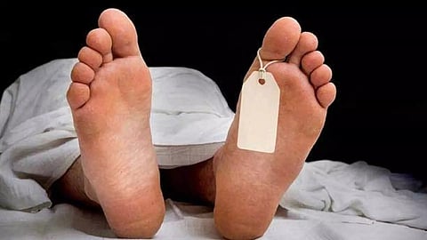 Representative Image