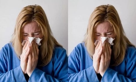 Representative Image