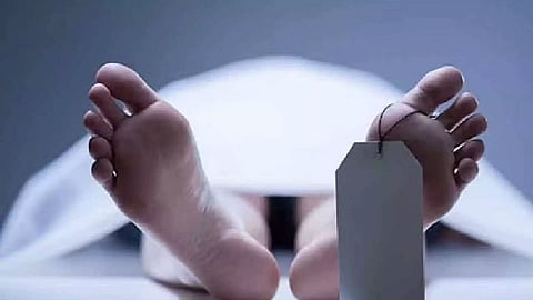 Representative Image