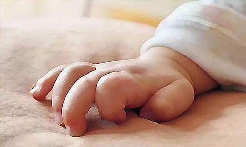 Representative image