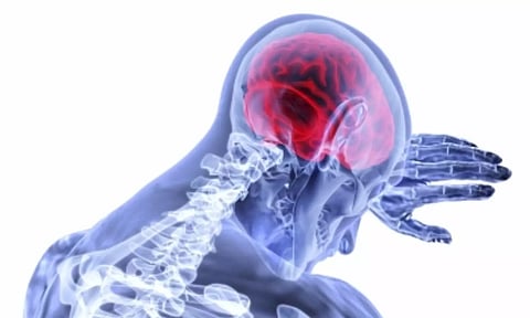 Representative Image&nbsp;