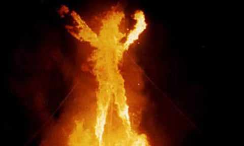 Representative Image