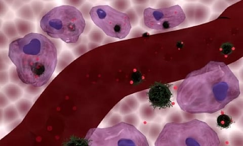 Representative image