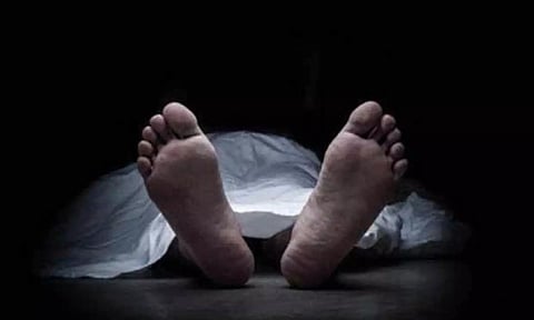 Representative Image