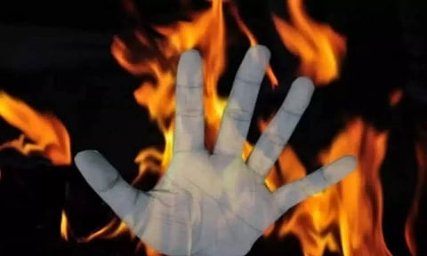 Representative Image