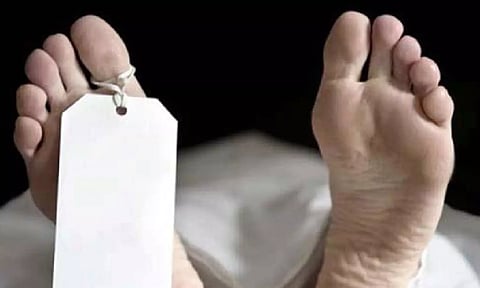 Representative Image