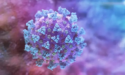 Representative image