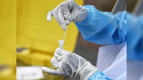 Representative Image