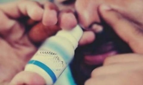 Representative image