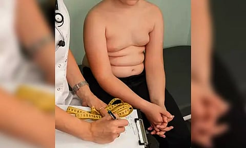 Representative image