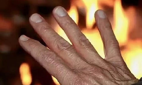 Representative image (File)