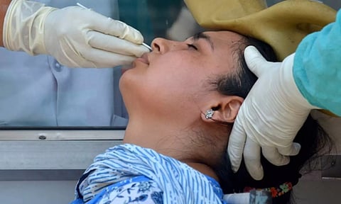 Representative image