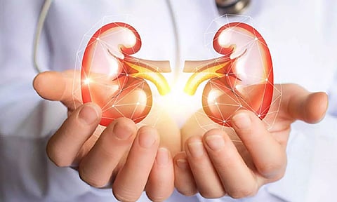 Representative Image