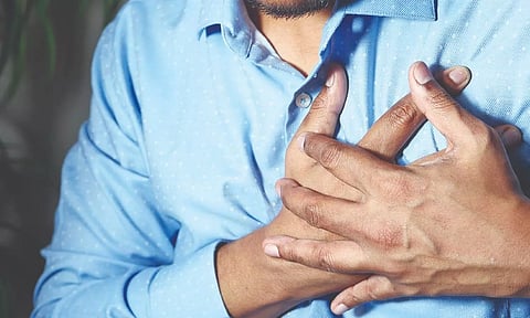 Representative image