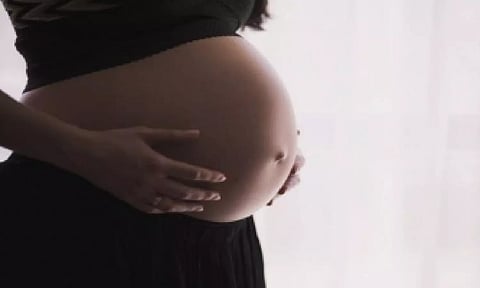 Representative image