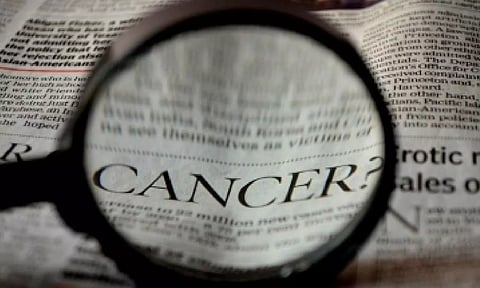 Representative image