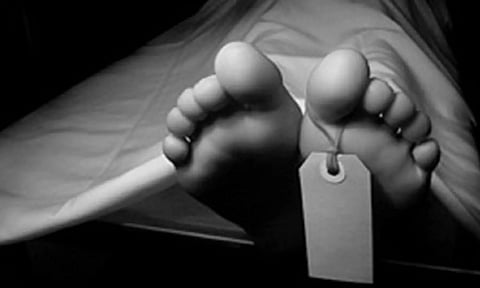 Representative Image