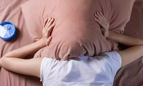 Representative image