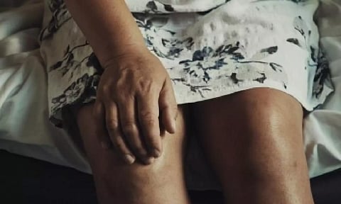 Representative image