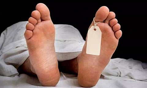 Representative Image