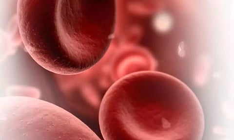 Representative Image