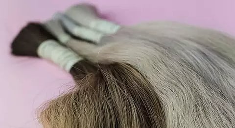 Representative image