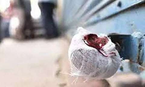 Representative image (File)