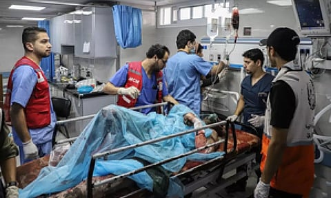 Representative image