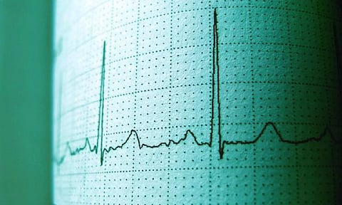 Representative Image (ANI)