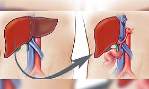 Representative Image (IANS)