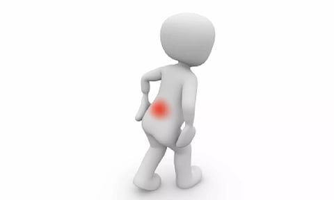 Representative image