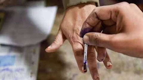 Representative Image